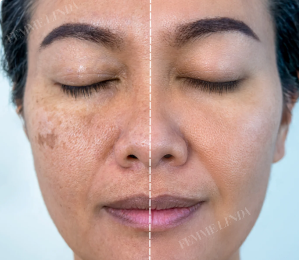 Femme Glow: Korean Sponge for Age Spot Removal