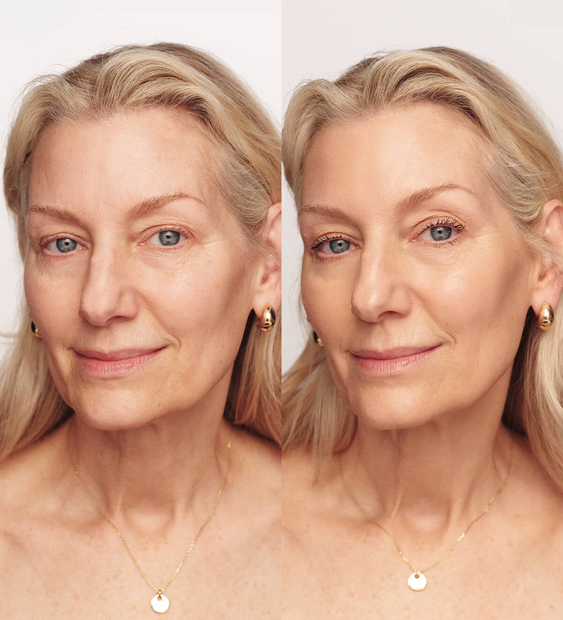 Femme Skin: 4-in-1 Rejuvenating Device